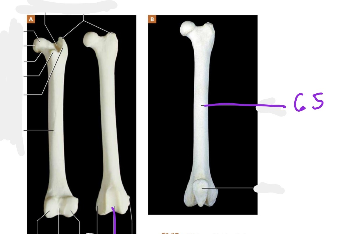 <p>Left picture, Right bone, bottom</p><p>Right picture 2 bones</p>