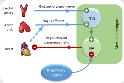 <p>-Vagal parasympathetic outflow <strong>exerts inhibitory control over heart rate</strong> by <span class="tt-bg-yellow">releasing acetylcholine</span><span class="tt-bg-red"> onto muscarinic receptors</span> in the <span class="tt-bg-blue">sinoatrial node</span>.</p><p>-<strong>Decreased vagal tone</strong> or withdrawal of vagal input allows <span class="tt-bg-green">sympathetic influence to predominate</span>, leading to an increase in heart rate.</p><p>-Sinus tachycardia often occurs in response to stress, exercise, or other factors that increase sympathetic activity or reduce parasympathetic tone.</p><p>-Respiratory sinus arrhythmia may modulate heart rate during the respiratory cycle, with slight increases in heart rate during inspiration due to reduced vagal activity.</p>