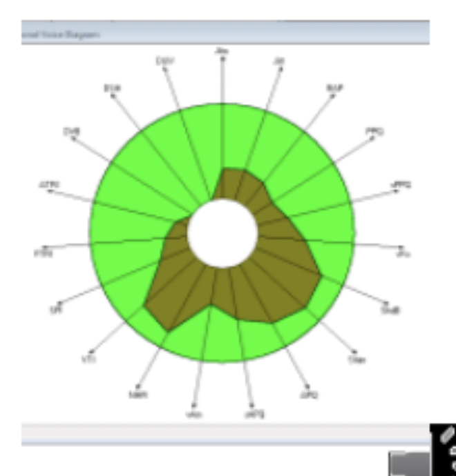 <p>◦ Perceptual: hoarseness; potential pitch changes. </p><p>Patient may complain about sensations of discomfort and dryness in the throat area</p><p>◦ Acoustic: greater than normal frequency and amplitude perturbation</p>