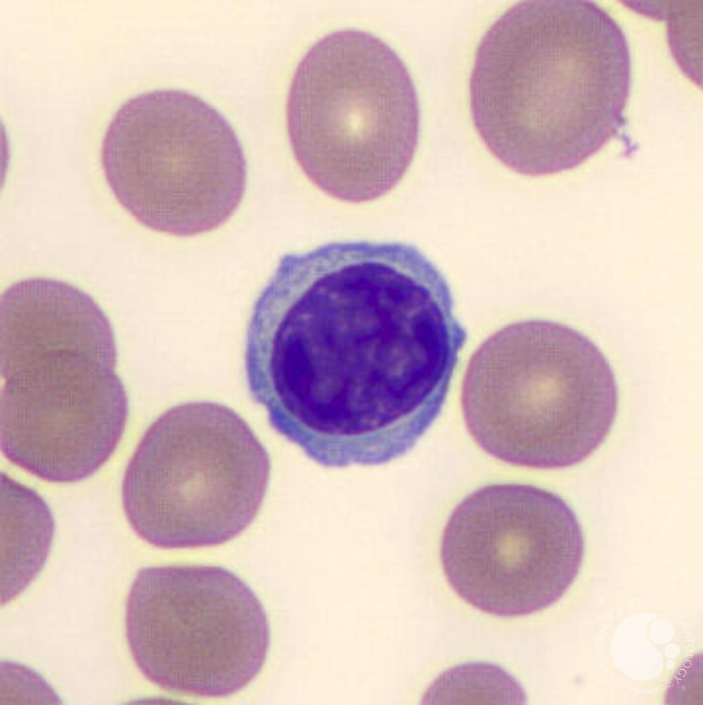 <p>-They are part of the immune system</p><p>-2 main types - T- and B- Lymphocytes</p><p>-Spherical cells with a single, often large nucleus which occupies much of the cells volume</p>