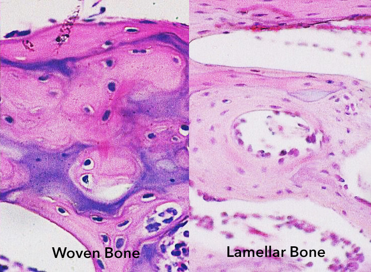 <p>Lamellar bone is <strong>mature</strong> (secondary) bone.</p><p>It is organized into <strong>concentric layers</strong> called lamellae.</p><p>These layers are arranged into <strong>osteons</strong> (functional units of bone).</p><p>Lamellar bone is <strong>mineralized</strong>, with fewer cells and ground substance compared to woven bone.</p>