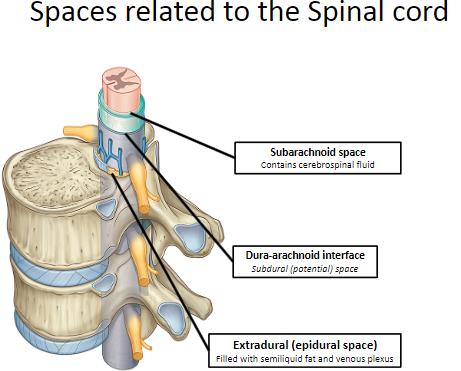 <p>The space outside the dura mater.</p><p>Filled with <strong>semiliquid fat</strong> and a <strong>venous plexus</strong>.</p>