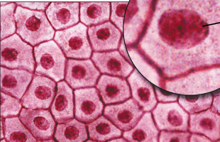 <p>Stratified squamous, here's surface view </p>