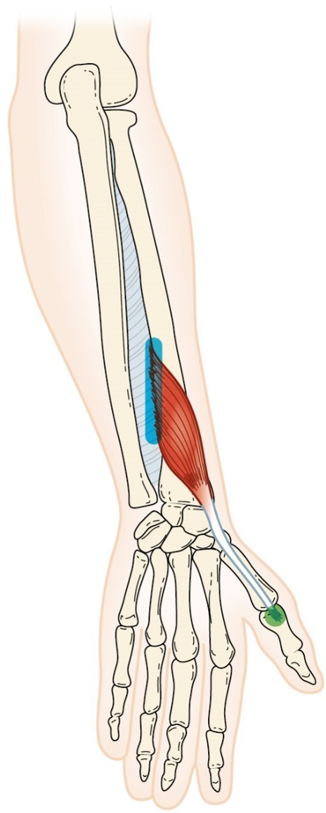 <p>Extensor Pollicis Brevis</p>