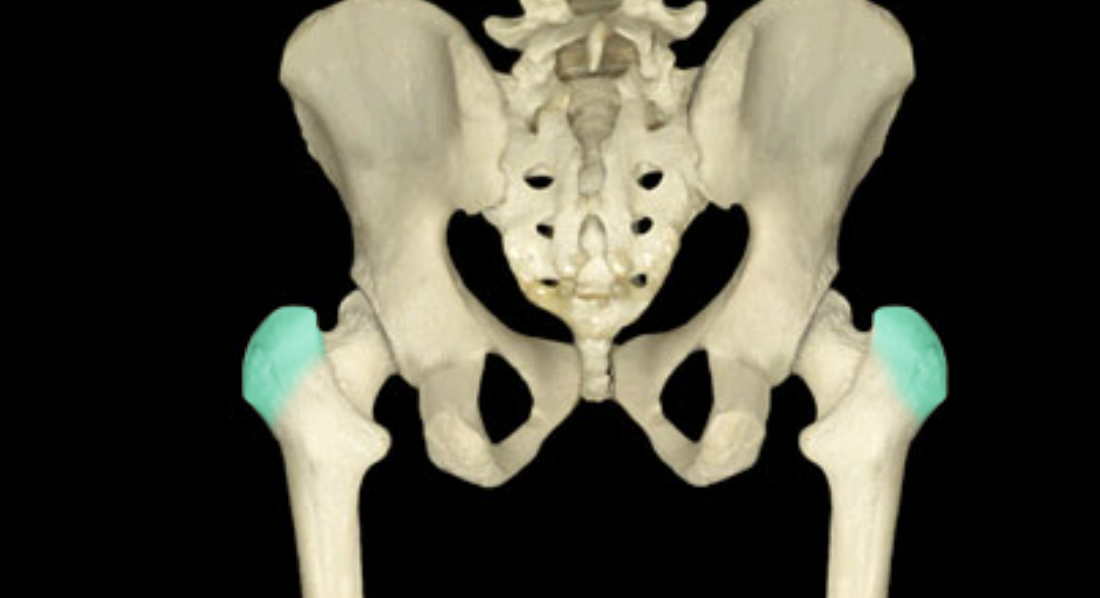 <p>of femur</p>