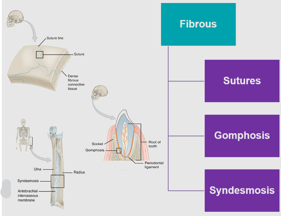 <p><strong>Fibrous Joints</strong>: Composed of tough fibrous tissue, providing strength and stability over mobility.</p><p><strong>Sutures</strong>:</p><p>Immovable joints (Synarthrosis)</p><p>Found only between skull bones</p><p><strong>Gomphoses</strong>:</p><p>Immovable joints</p><p>Attach teeth to maxilla</p><p><strong>Syndesmoses</strong>:</p><p>Slightly movable (Amphiarthroses)</p><p>Example: Interosseous membrane between bones</p>