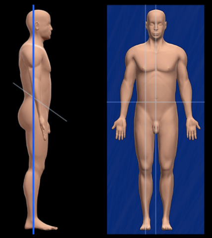 <p>What is the Coronal Plane?</p>