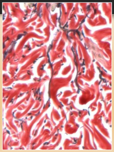 <p>The Verhoeff-Van Gieson stain is used to stain collagen fibers.</p><p>In this stain, collagen fibers appear red.</p>