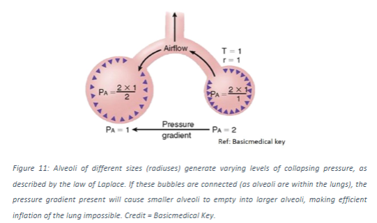 <p>When bubbles of varying size are connected, such as different-sized alveoli connected by airways, the smaller bubble will empty into the larger ones due to the pressure gradient.</p>
