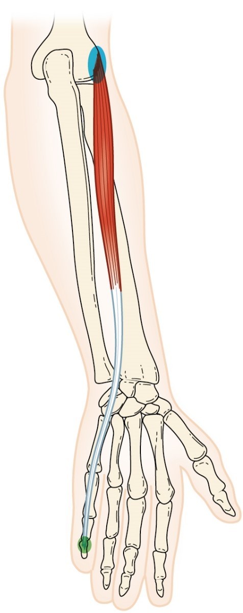 <p>Extensor Digiti Minimi</p>