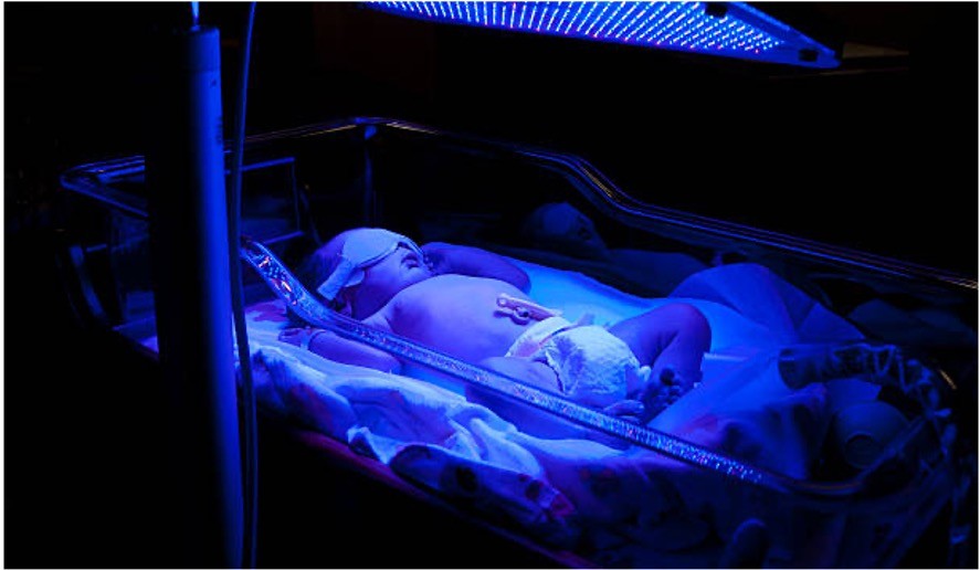 <p>Care for newborn receiving phototherapy:</p>