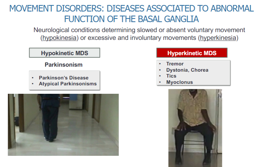 <p><strong>Hypokinetic movement disorders (MDS):</strong></p><p>Slowed or absent voluntary movements (hypokinesia)</p><p><strong>Parkinsonism:</strong></p><p>Parkinson's Disease</p><p>Atypical Parkinsonisms</p><p><strong>Hyperkinetic movement disorders (MDS):</strong></p><p>Excessive and involuntary movements (hyperkinesia)</p><p>Tremor</p><p>Dystonia</p><p>Chorea</p><p>Tics</p><p>Myoclonus</p>