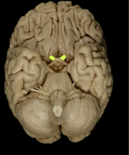 <p>Location of the Optic Nerve</p>