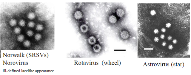 <p>♡ Noroviruses</p><p>♡ Rotaviruses</p><p>♡ Astroviruses</p>