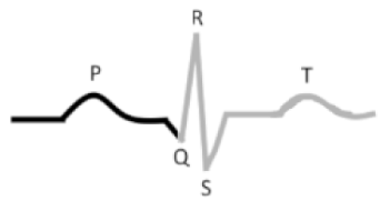 <p>What is this?</p><p>Period from the beginning of ventricular __________ through ventricular ___________</p>