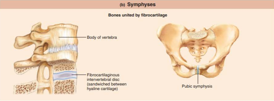 <p>a joint where fibrocartilage unites the bone</p><p>amphiarthroses</p><p>shock absorber</p>