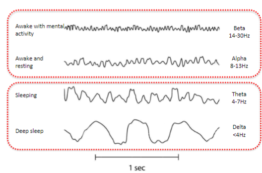 <p>EEG rhythms can be categorized by their frequency range.</p>