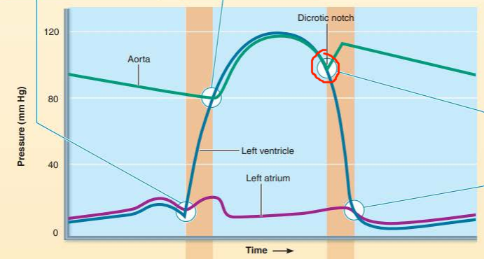 <p>describe the valve events happening</p><p>what sound does it cause?</p><p></p><p></p><p>____________ _______ close when the _____________ ________ drops below the ______ ___________ resulting in the ________ heart sound</p>