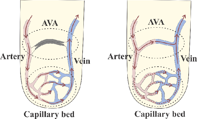 <p>Arterio-venous anastomoses are direct connections between arterioles and venules that expose blood to regions of high surface area, facilitating heat exchange through convection, conduction, radiation, and evaporation in cutaneous circulation</p>