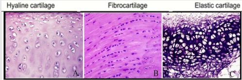 <p>Hyaline cartilage</p><p>Fibrocartilage</p><p>Elastic cartilage</p>