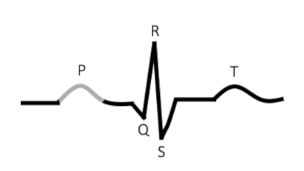 <p>what is this?</p><p>Results from movement of the ______________ wave from the __________ through the ____</p>