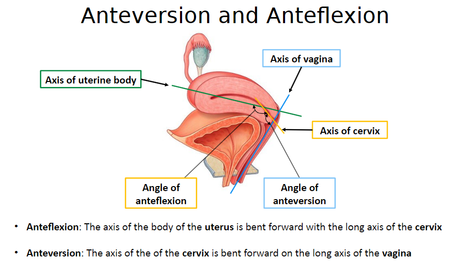 <p>Anteflexion is when the axis of the body of the uterus is bent forward with the long axis of the cervix.</p>
