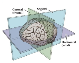 <p>Divides the brain into <strong>two hemispheres</strong>.</p><p><strong>Midsagittal:</strong> Cuts along the midline of the brain.</p><p><strong>Parasagittal:</strong> Cuts more laterally, away from the midline.</p>