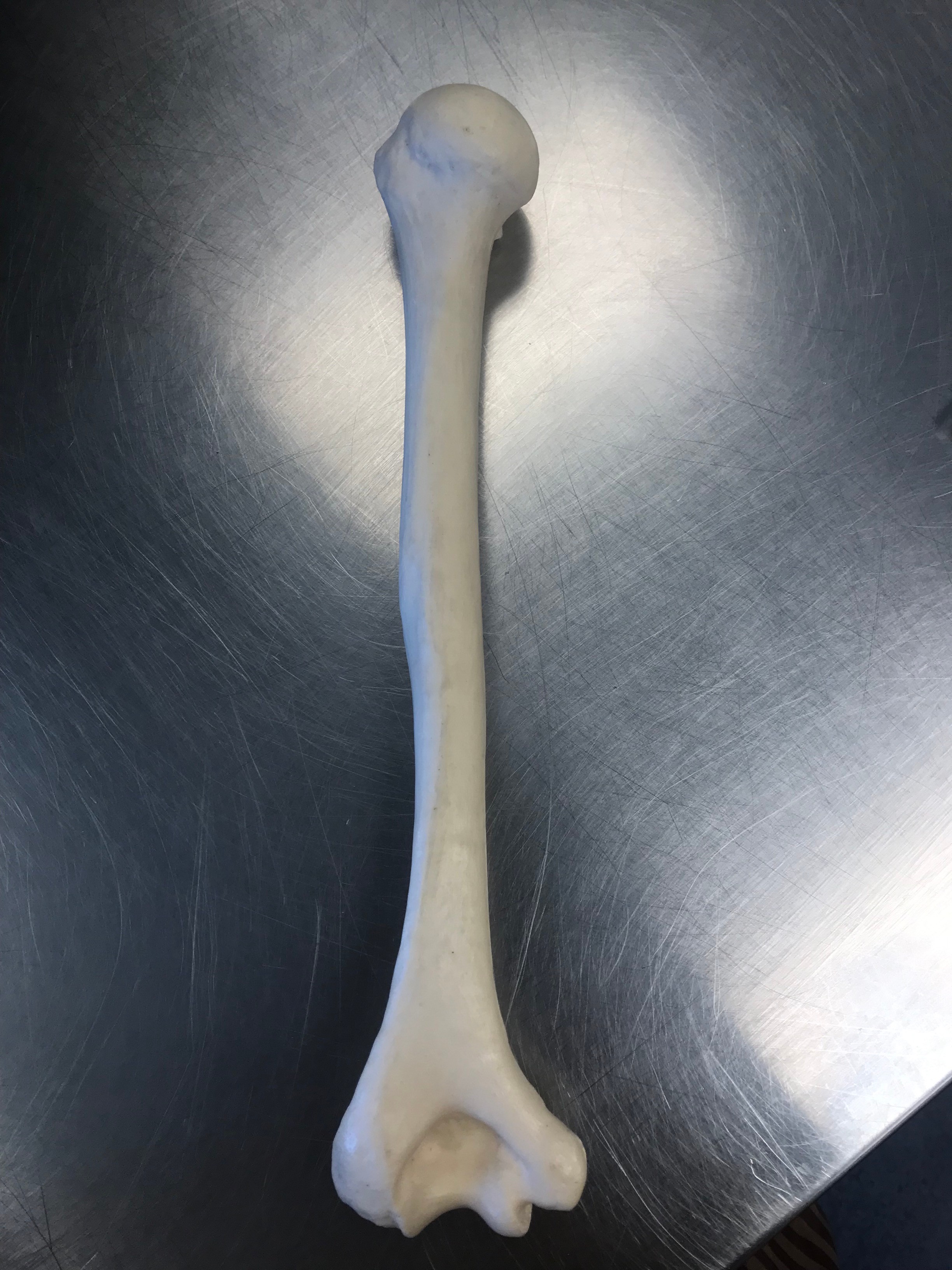 <p>What bone is this? </p>