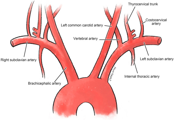 <p><strong>Right subclavian artery</strong>: Arises from the brachiocephalic trunk.</p><p><strong>Left subclavian artery</strong>: Arises directly from the aortic arch.</p>