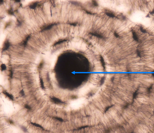 <p>What is this area of this tissue?</p>