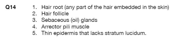 <p>Q15: dense irregular connective tissue</p>