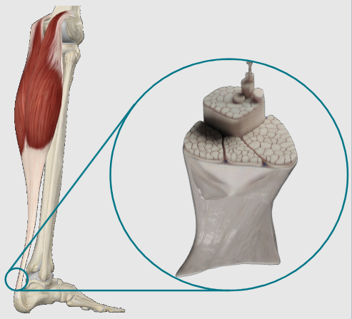 <p>Dense connective tissue.</p>