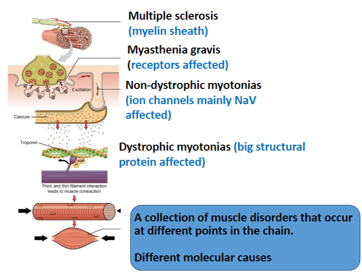 <p>The <strong>myelin sheath</strong> in the <strong>central nervous system (CNS)</strong> is targeted.</p><p>This results in <strong>immune attacks</strong> on myelin, leading to impaired nerve conduction.</p>