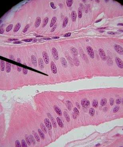 <p>What type of tissue is this? Where in the body could you find this tissue type?</p>