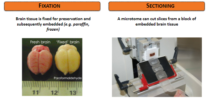 <p><strong>Sectioning:</strong> A microtome is used to cut slices from a block of embedded brain tissue.</p><p><strong>Fixation:</strong> Brain tissue is fixed for preservation and then embedded (e.g., in paraffin or frozen).</p>