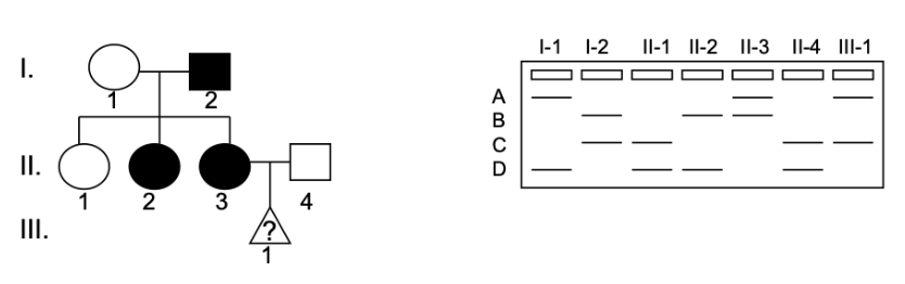 <p>Mutations in the <em>adenomatous polyposis of the colon</em> (<em>APC</em>) gene predisposes a person to colorectal cancer. Below is the DNA nucleotide sequence of the <em>APC </em>gene on the coding strand from an unaffected individual and an individual who was diagnosed with colorectal cancer.&nbsp;</p><p>&nbsp;</p><p>What type of mutation occurred in the individual that has colorectal cancer?</p><p>&nbsp;</p><p>Note this sequence is from the middle of the APC gene.&nbsp; Please use the first 3 nucleotides for the first codon of this part of the APC gene.</p><p></p><p>a) missense</p><p></p><p>b) nonsense</p><p></p><p>c) frameshift</p><p></p><p>d) silent</p>