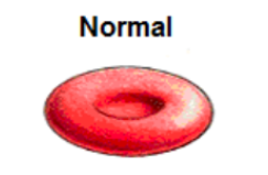 <p>no net movement of water, an equal amount of solutes inside and outside the cell </p>