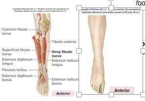 <p>L4-S1</p><p><strong><u>Motor Innervation</u></strong></p><p><strong>Anterior leg muscles </strong>(<em>dorsiflex foot, extend toes</em>)</p><p>Tibialis anterior (<em>inverts foot</em>)</p><p>Extensor hallucis longus</p><p><strong>Dorsum foot muscles </strong>(<em>extend toes</em>)</p><p>Extensor digitorum brevis</p><p><strong><u>Cutaneous Innervation</u></strong></p><p>dorsal interspace between 1st and 2nd toe</p>