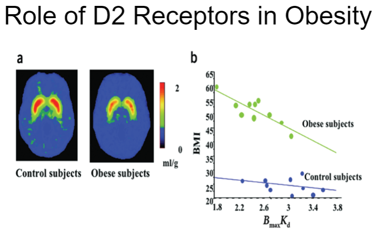 <p><strong>D2 receptors</strong> are part of the <strong>dopaminergic system</strong> and play a role in motivation and reward.</p><p>Reduced <strong>D2 receptor availability</strong> has been linked to <strong>increased food intake</strong> and <strong>obesity</strong>, as it can impair the brain’s ability to process reward signals from food.</p><p>Lower D2 receptor activity may lead to an increased tendency to seek out and consume high-reward foods, contributing to overeating.</p>