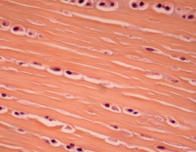 <p>dense regular connective tissue</p>