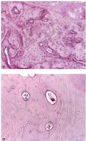 <p><strong>Woven bone</strong> (primary, immature): Random arrangement of collagen fibers; found in fetal development and during bone repair.</p><p><strong>Lamellar bone</strong> (secondary, mature): Organized in concentric layers (lamellae) and osteons; found in mature bone.</p>