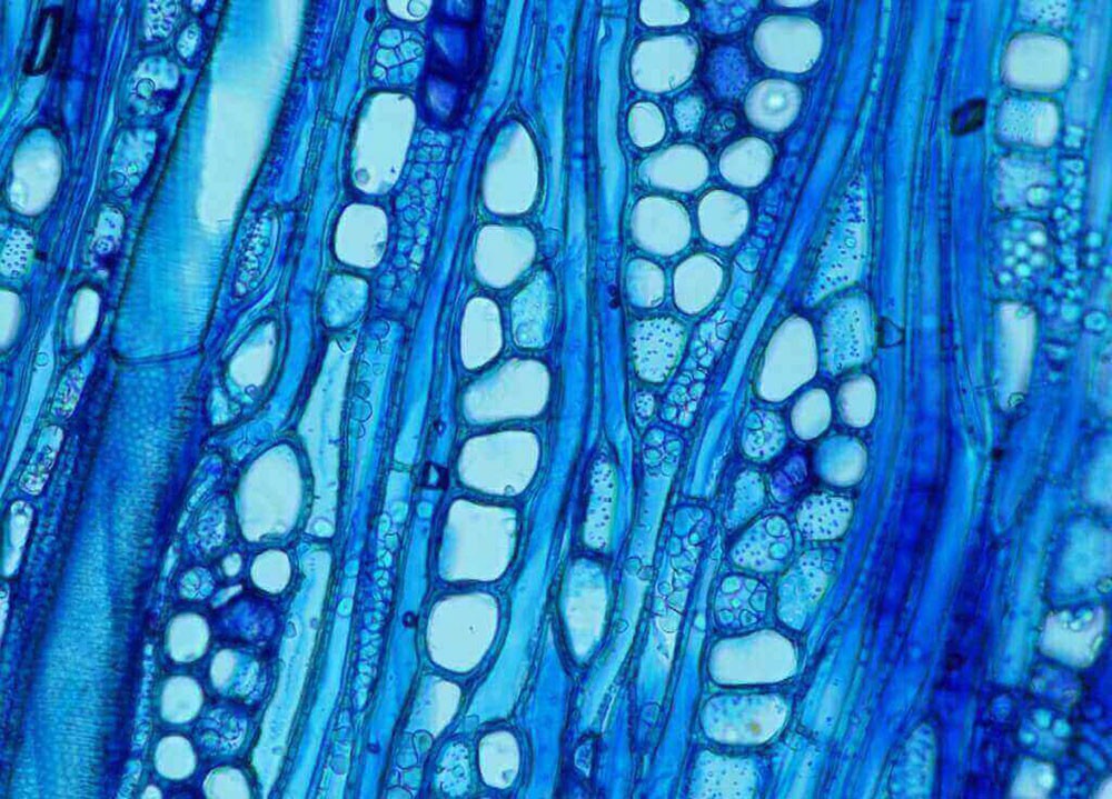 Xylem cell