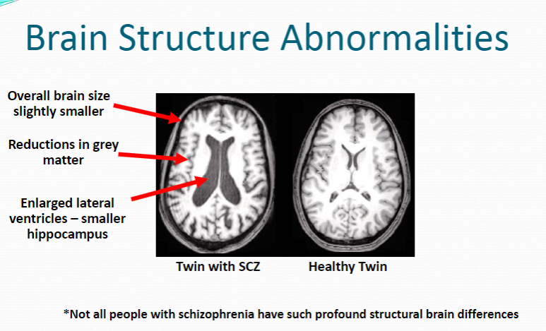 <p><strong>Slightly smaller brain size</strong></p><p><strong>Reductions in grey matter</strong></p><p><strong>Enlarged lateral ventricles</strong> and <strong>smaller hippocampus</strong></p>