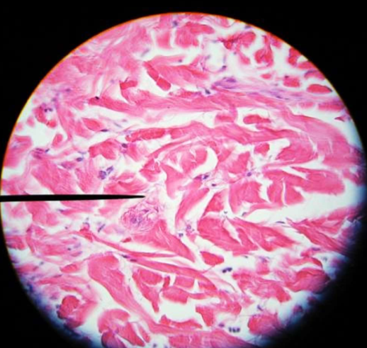 <p>What tissue type is this?</p>