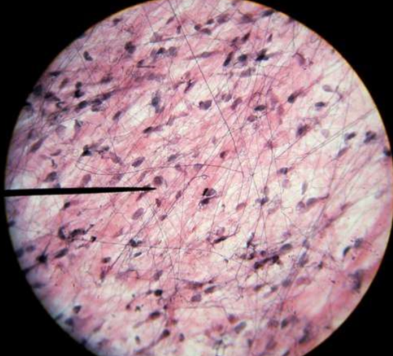 <p>What tissue type is this?</p>