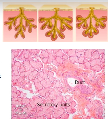 <p>What kind of gland is this?</p>