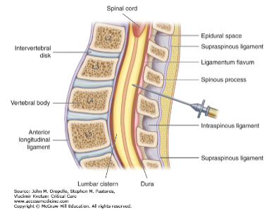 <p>A needle is used to collect a sample of <strong>cerebrospinal fluid</strong> from the <strong>subarachnoid space</strong>.</p>