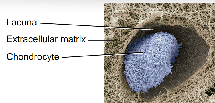 <p>Chondrocytes (located in cavities in the matrix called lacunae) and chondroblasts </p>