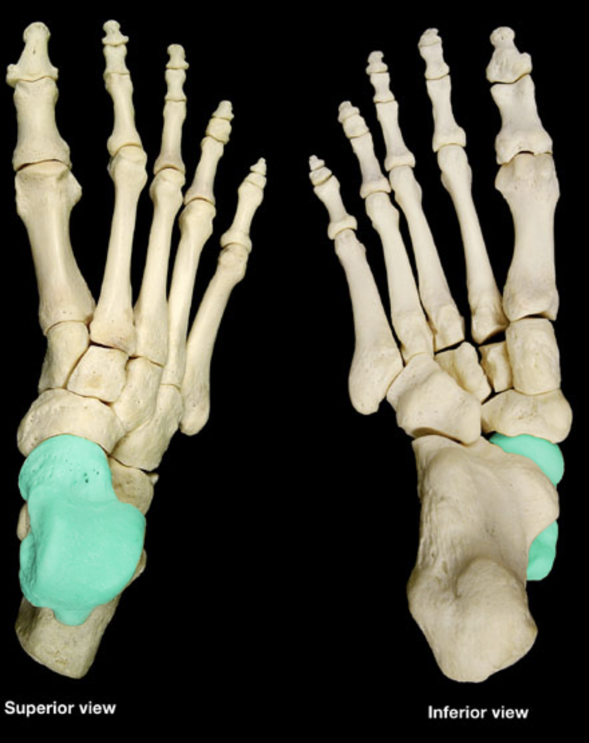 <p>of tarsals</p>