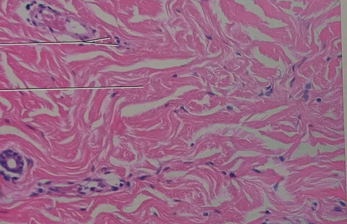 <p>Identify this tissue</p><p></p><p>Name a function</p><p></p><p>Name a specific place where it is found</p>